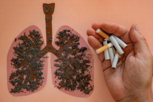 Smoking tobacco Lung cancer